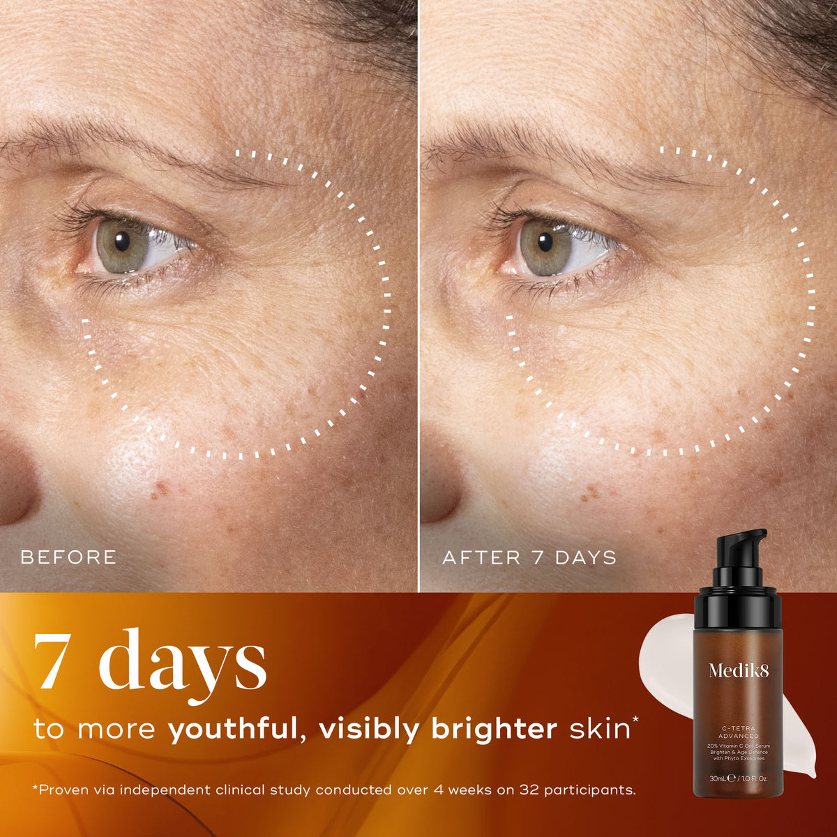 Medik8 C-Tetra Advanced cheek comparison labelled before and after seven days, with a skin texture caption.
