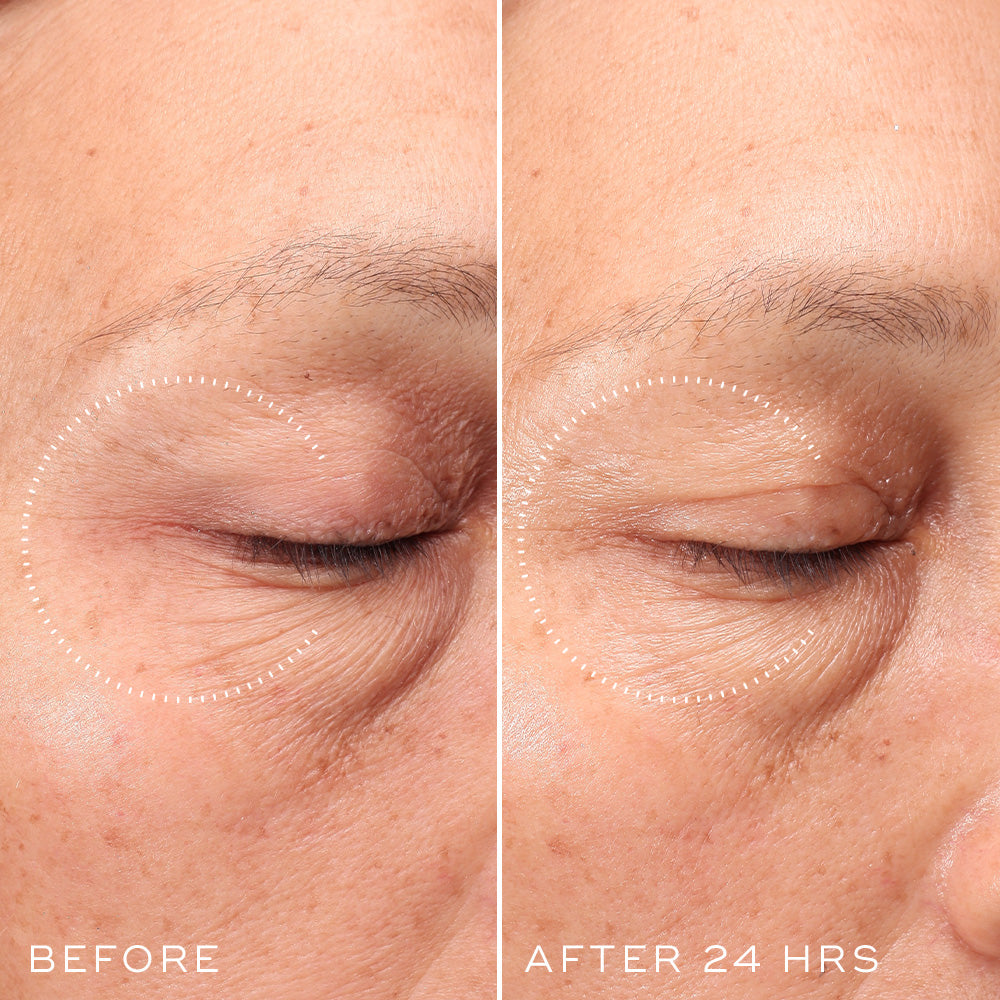 Medik8 Crystal Retinal Ceramide Eye before and after image showing the eye area after 24 hours