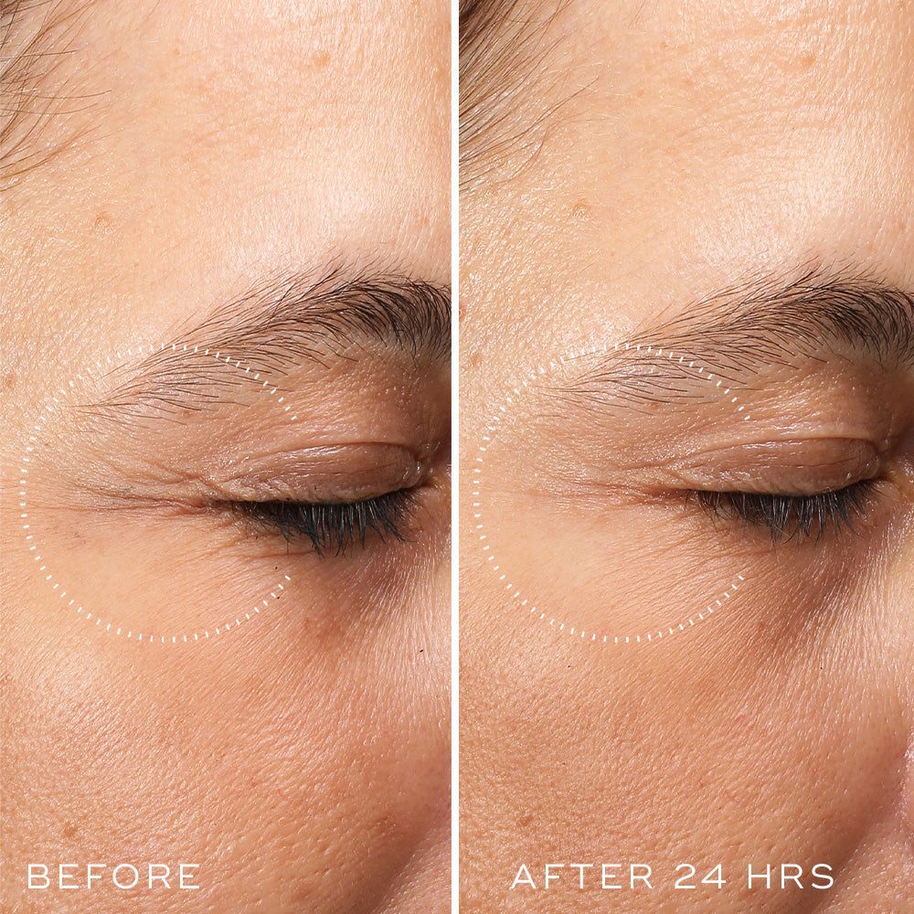 Second Medik8 Crystal Retinal Ceramide Eye before and after image showing the eye area after 24 hours