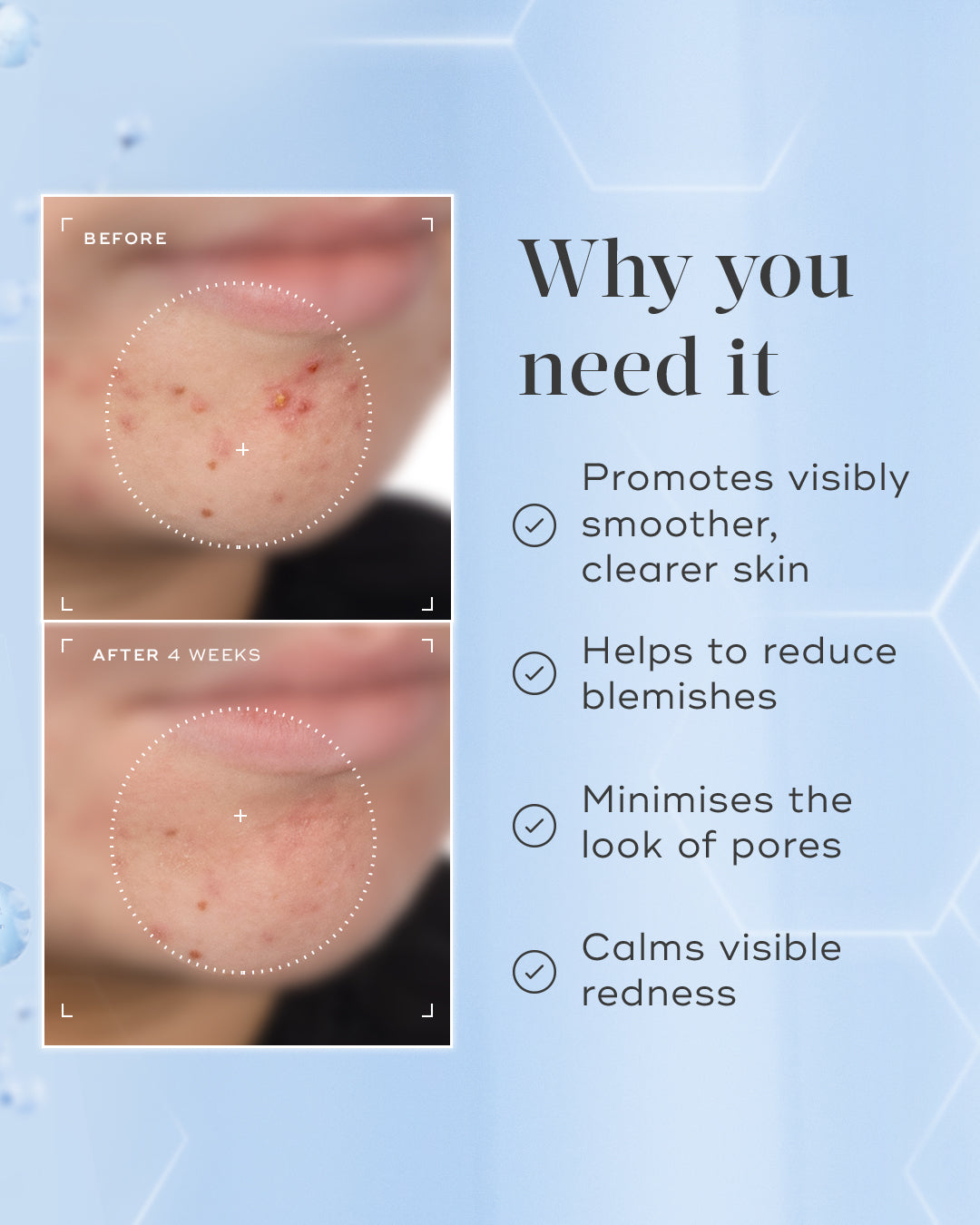 Medik8 Niacinamide Peptides benefits graphic with a four-week before and after image