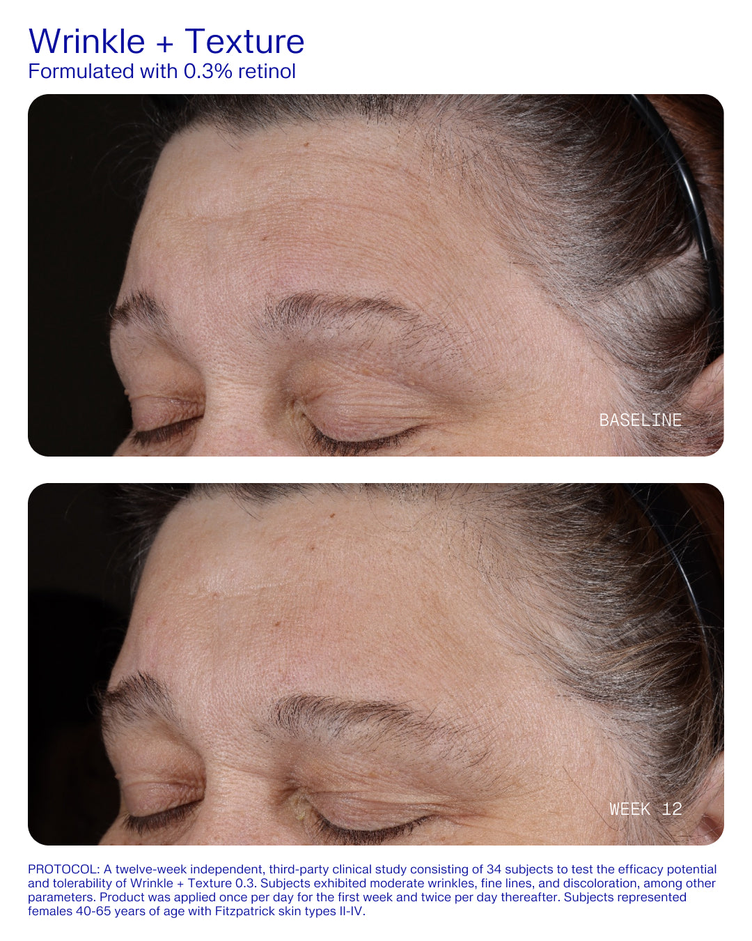 Wrinkle + Texture 0.3% Retinol