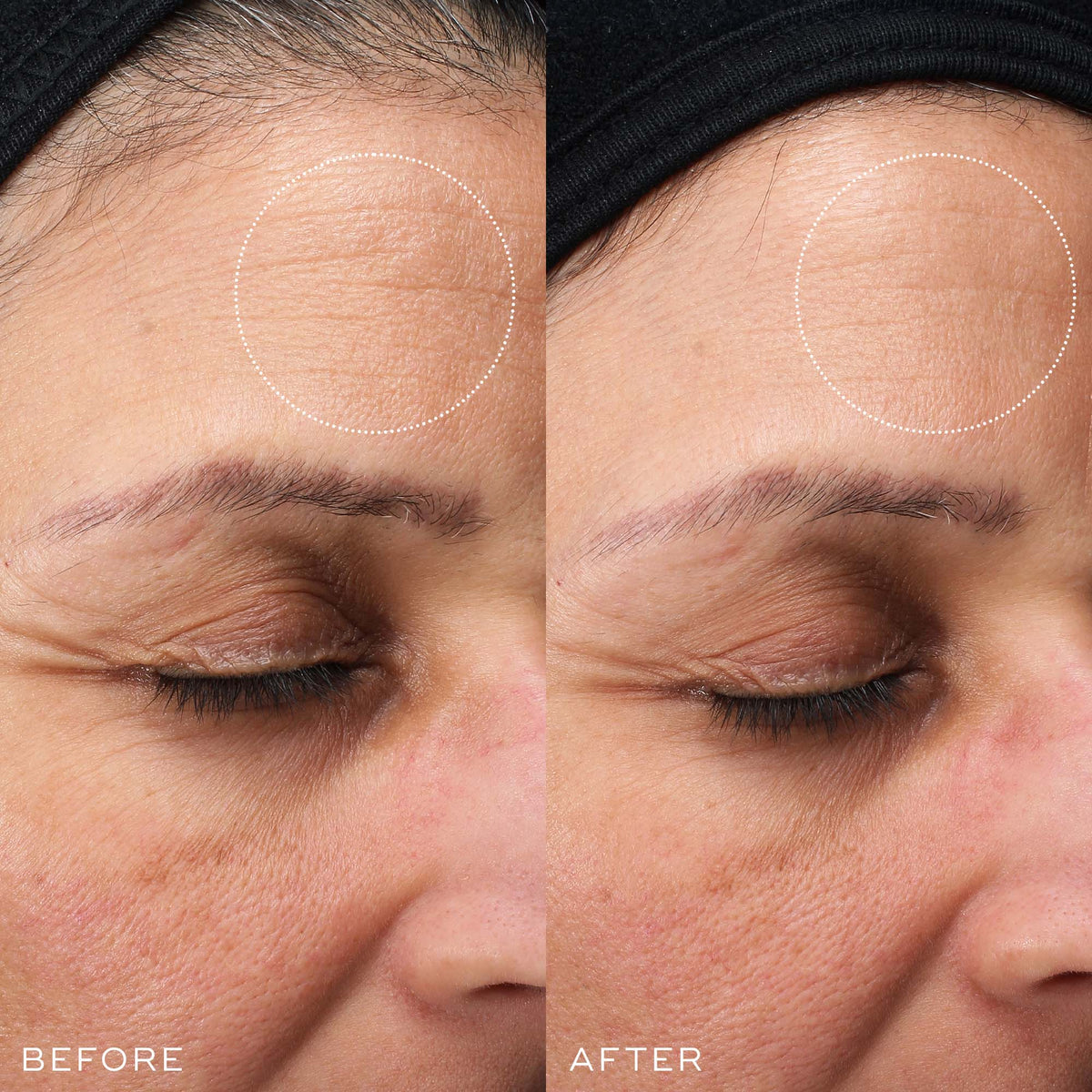 Medik8 Sleep Glycolic results comparison showing smoother, more even-looking skin