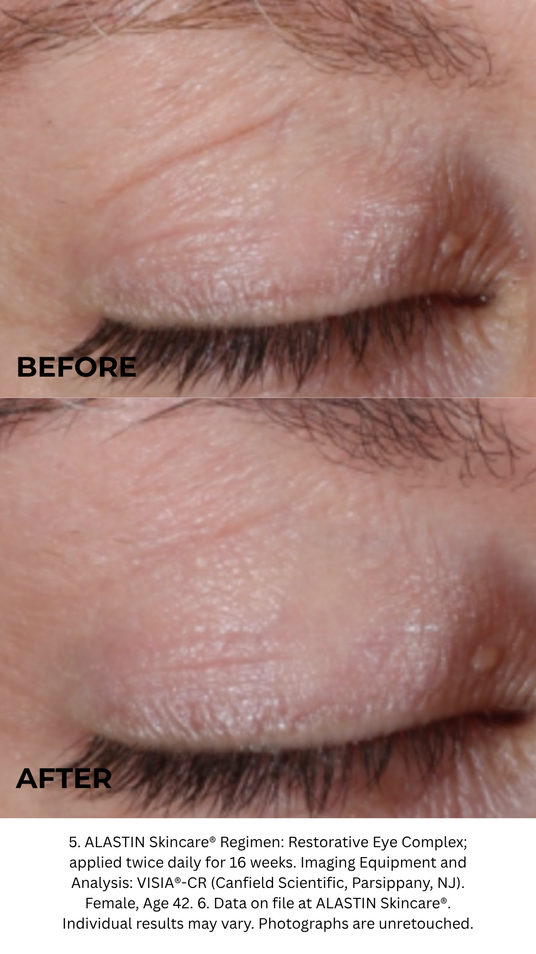 Restorative Eye Complex