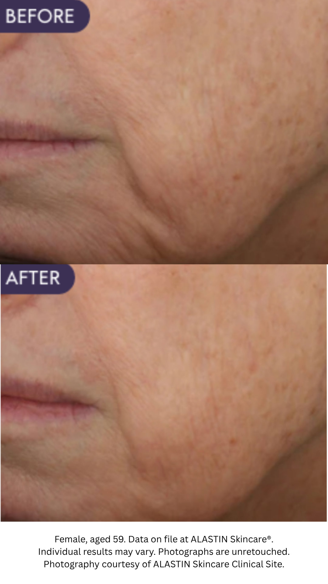 Restorative Skin Complex with TriHex Technology