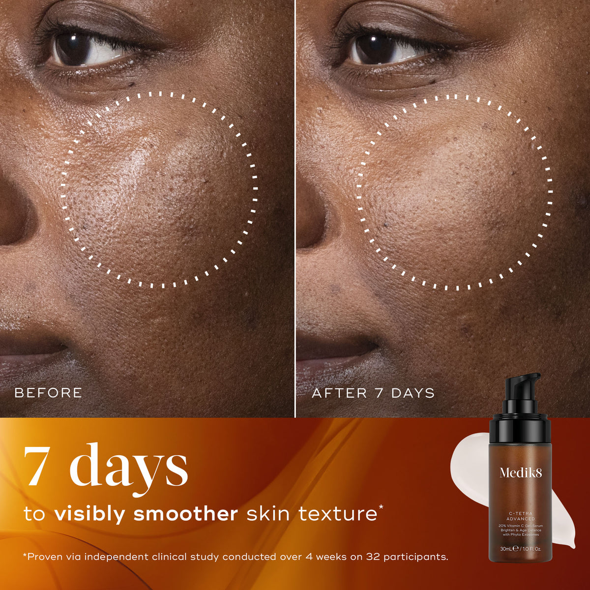 Medik8 C-Tetra Advanced facial comparison labelled before and after seven days, with a skin brightness caption.