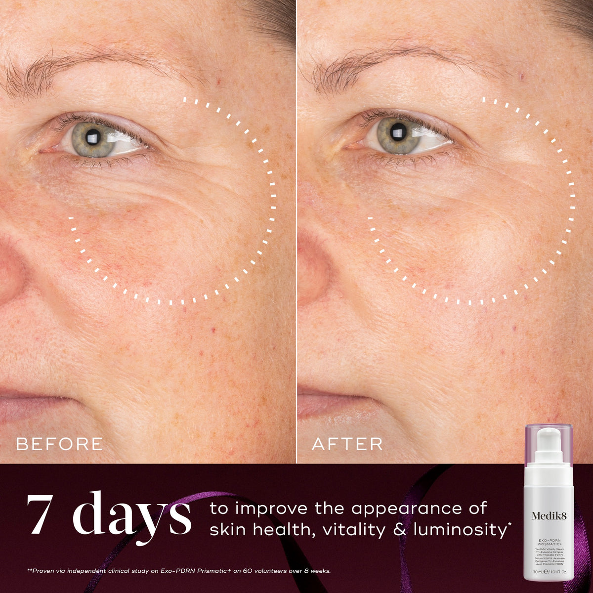 Medik8 EXO-PDRN Prismatic+ before and after image showing skin vitality and luminosity results after 7 days