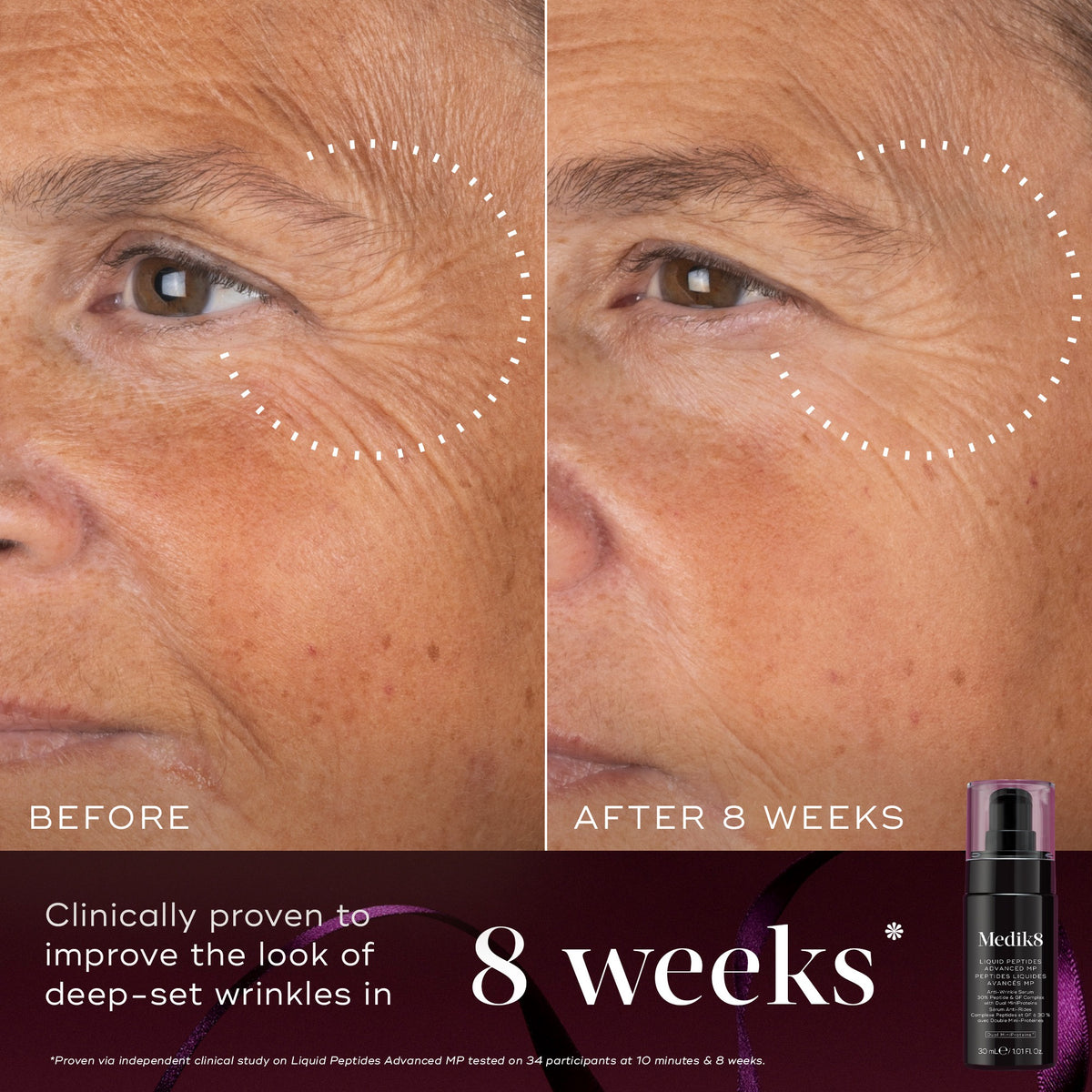 Medik8 Liquid Peptides Advanced MP before and after image showing the appearance of eye-area wrinkles after 8 weeks