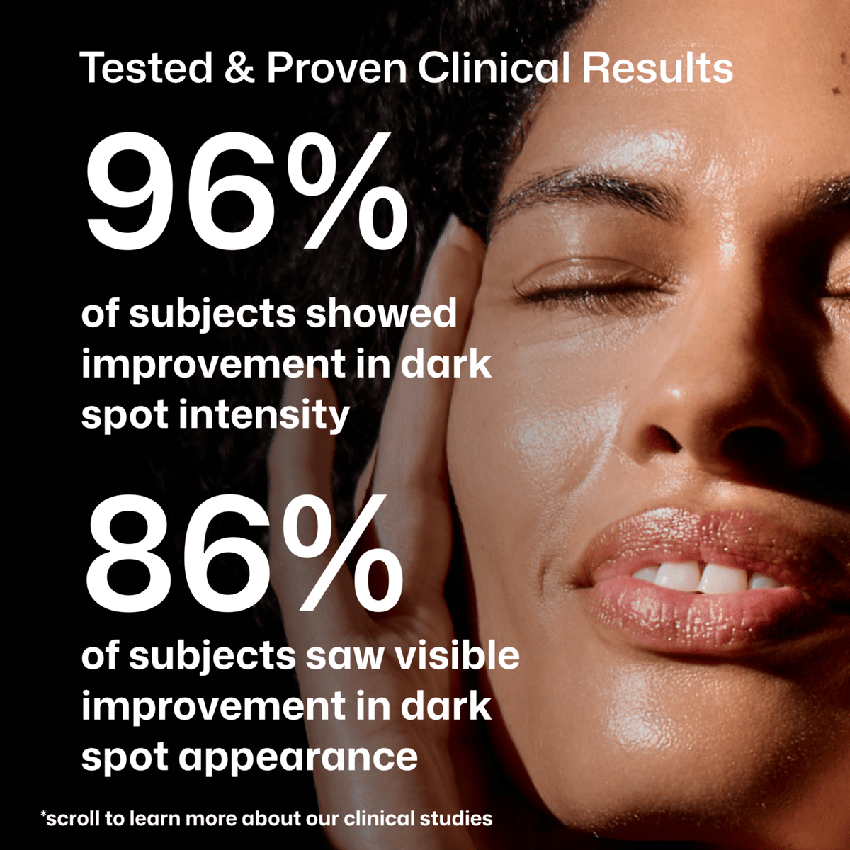 Revision Skincare Advanced Pigment Corrector+ clinical-results graphic showing 96% and 86% study figures beside a model.