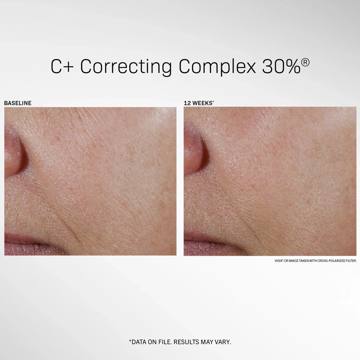 Revision Skincare C+ Correcting Complex 30% comparison showing cheek photographs at baseline and 12 weeks.