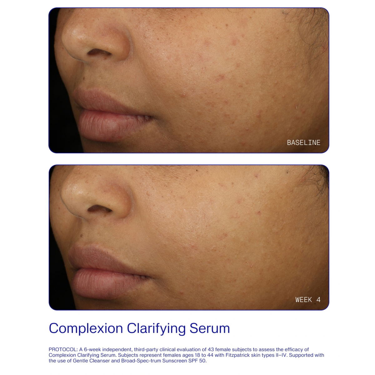 ZO Skin Health Complexion Clarifying Serum facial before and after image at baseline and week 6